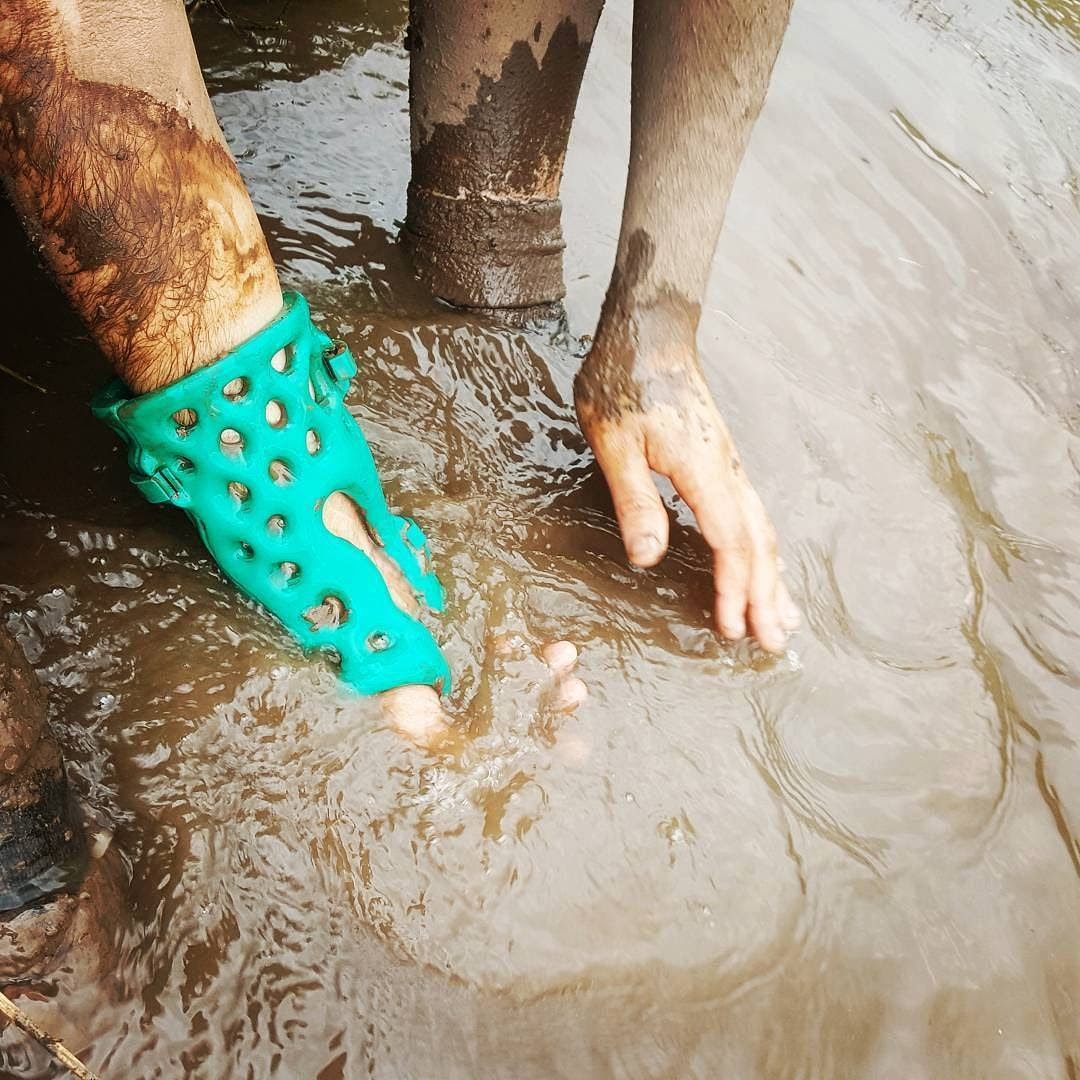i-3d-printed-a-waterproof-cast-turned-it-into-a-500k-year-business