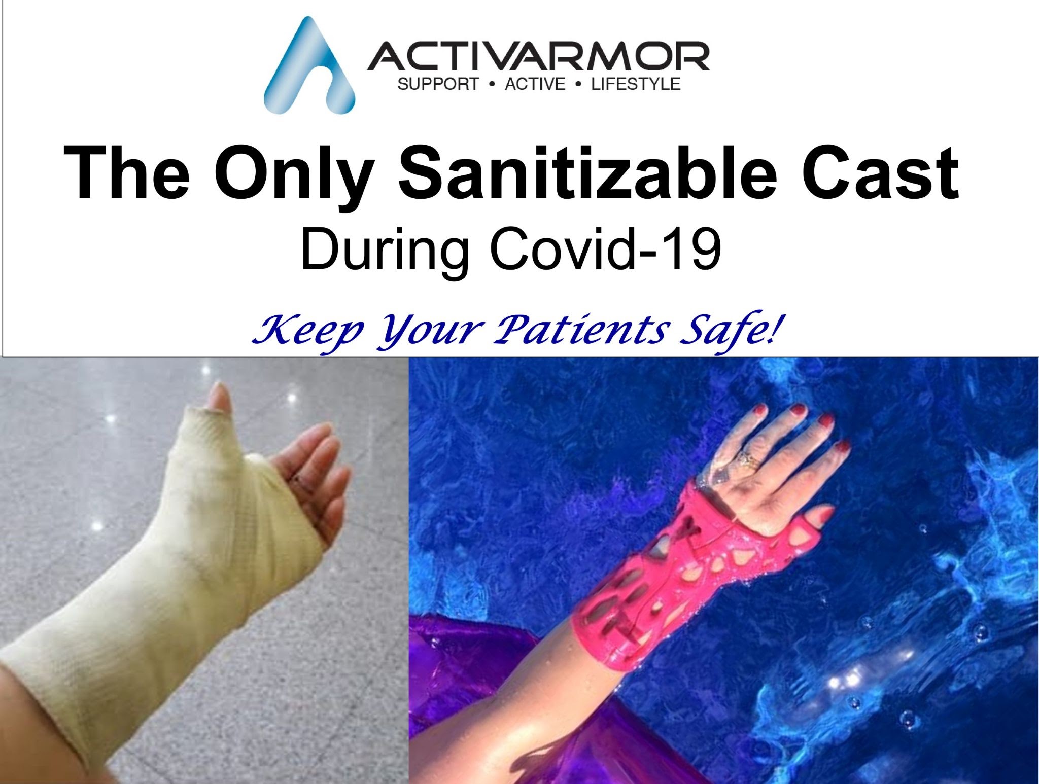 i-3d-printed-a-waterproof-cast-turned-it-into-a-500k-year-business